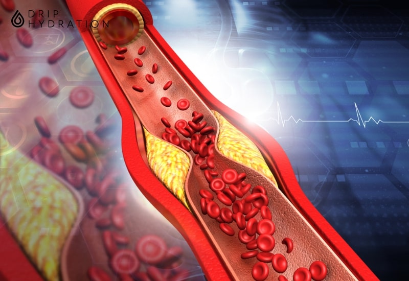 chỉ số triglyceride cao