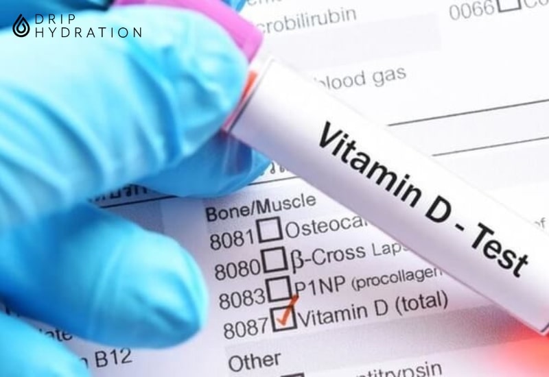 xét nghiệm vitamin d