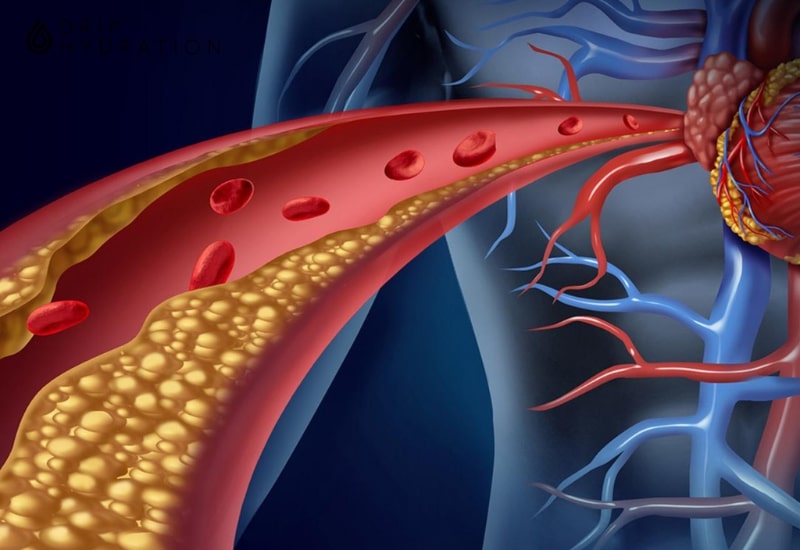 Nhiều người thắc mắc dấu hiệu cholesterol cao là gì?