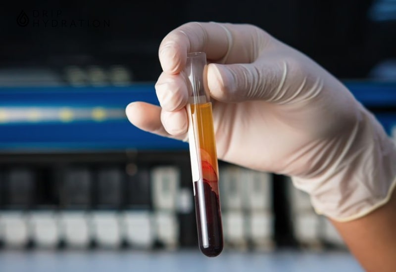 Xét nghiệm PT được tiến hành trên mẫu bệnh phẩm là mẫu máu