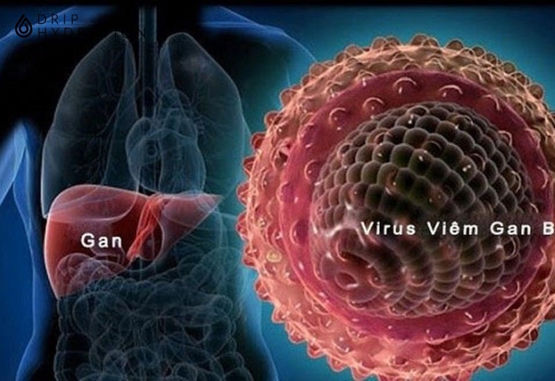 Xét nghiệm HBsAg là xét nghiệm giúp chẩn đoán sớm về khả năng mắc virus viêm gan B