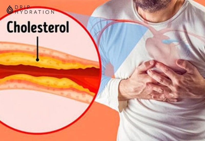 Cholesterol xấu (LDL- C) khiến cho tình trạng mỡ máu cao xảy ra