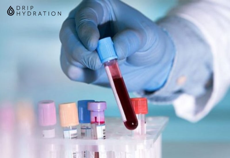 Xét nghiệm Anti Tg được thực hiện trên mẫu bệnh phẩm là mẫu máu