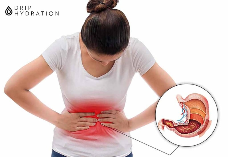 Đau bụng vùng thượng vị điển hình thường thấy ở cơn đau dạ dày