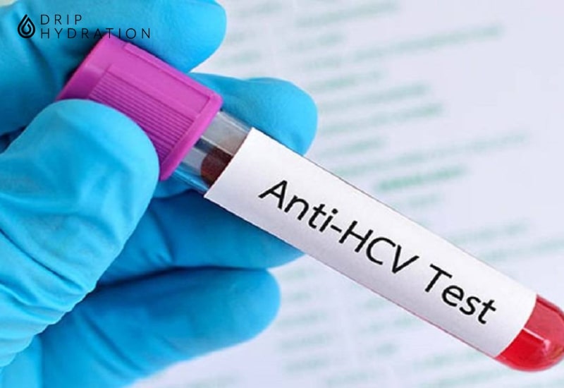 Xét nghiệm Anti HCV là xét nghiệm tìm kháng thể chống virus viêm gan C trong máu