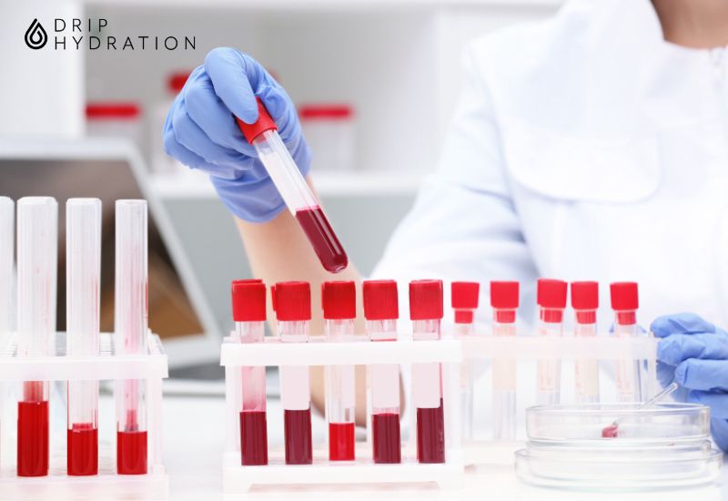 Chỉ số MONO trong xét nghiệm máu có thể được tiến hành riêng biệt hoặc tích hợp trong xét nghiệm tổng phân tích tế báo máu