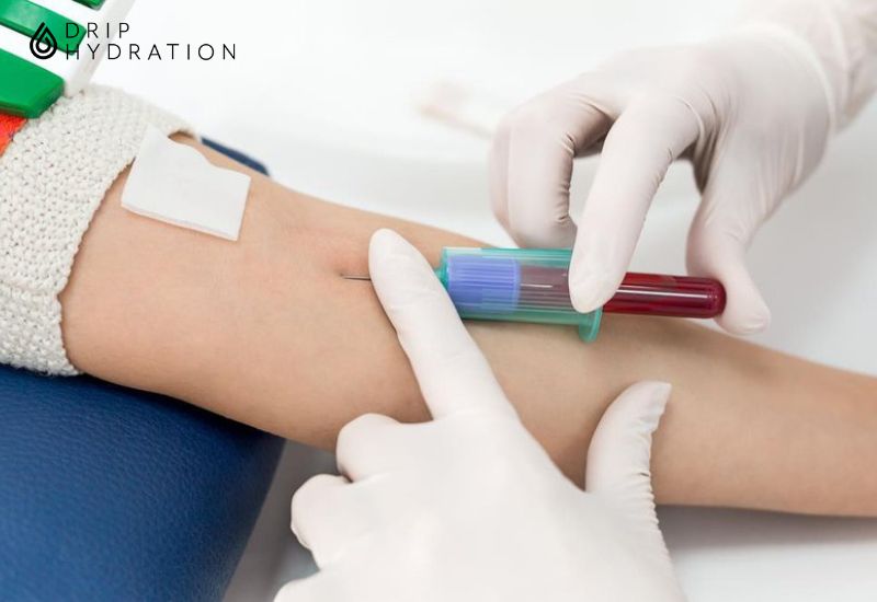 IG trong xét nghiệm máu - Ý nghĩa và vai trò của Immunoglobulin