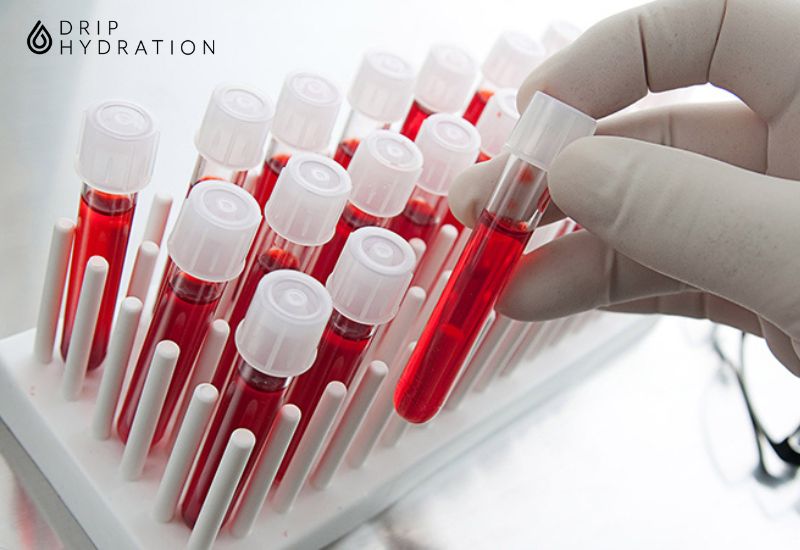 Xét nghiệm miễn dịch là một trong các loại xét nghiệm cơ bản nhằm kiểm ra sự đáp ứng của cơ thể với các kháng nguyên