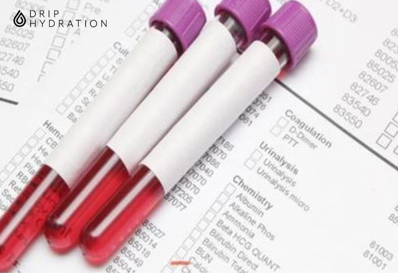 Có nhiều nguyên nhân dẫn đến chỉ số PLT trong xét nghiệm máu bất thường