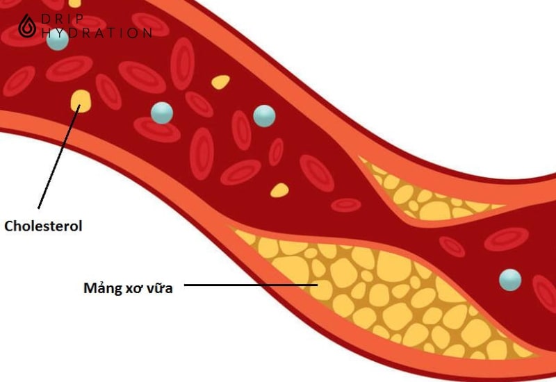 Ăn chay giúp giảm lượng cholesterol máu và ngăn ngừa biến cố tim mạch