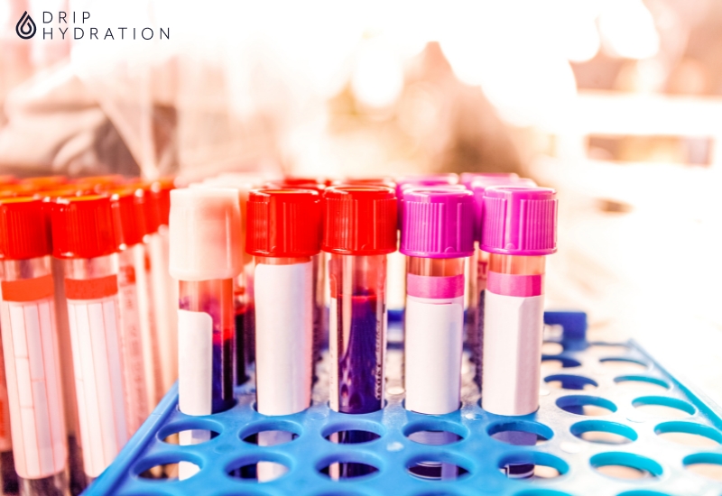 Chỉ số RDW-CV được thực hiện cùng trong xét nghiệm tổng phân tích tế bào máu