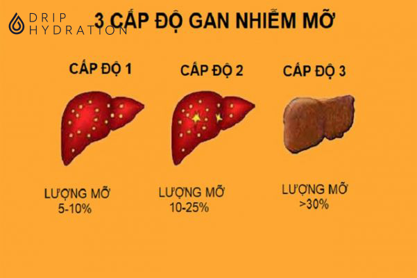 Gan nhiễm mỡ ăn gì và kiêng gì là vấn đề nhiều người quan tâm