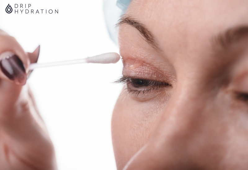 sụp mí mắt sau tiêm Botox