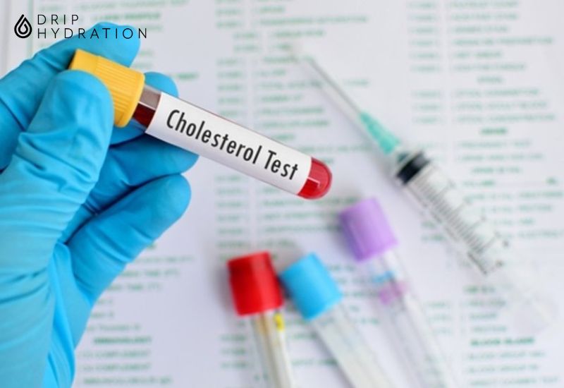 Bác sĩ sẽ xem xét nguy cơ tim mạch tổng thể của bệnh nhân thông qua xét nghiệm cholesterol để đặt ra mục tiêu giảm mỡ máu