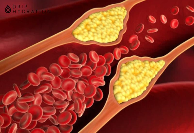 Vai trò của cholesterol trong cơ thể bạn không phải chỉ những vấn đề tiêu cực