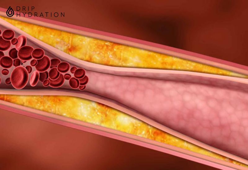 Giảm nồng độ HDL - Cholesterol ở những bệnh nhân béo phì giúp cải thiện tình trạng rối loạn mỡ máu