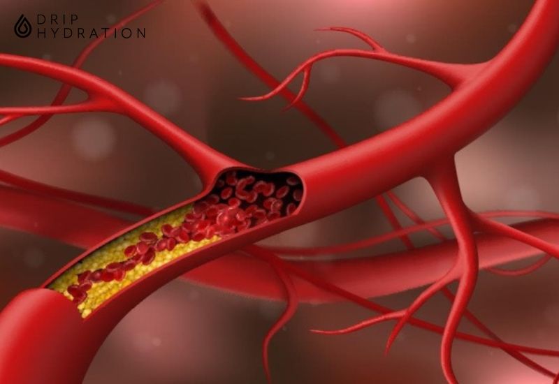 Cách kiểm soát lượng cholesterol trong cơ thể như thế nào là chuẩn nhất?