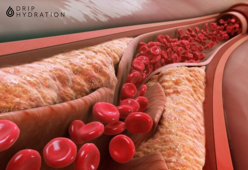 Sử dụng thuốc điều trị cholesterol như thế nào là câu hỏi được nhiều bệnh nhân quan tâm