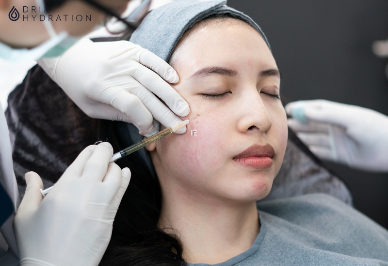 Botox thường mất từ ​​2 đến 5 ngày để bắt đầu có tác dụng