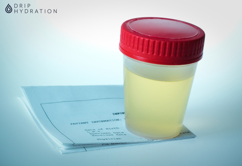 Đánh giá chức năng thận được thực hiện bằng phương pháp xét nghiệm máu hoặc nước tiểu