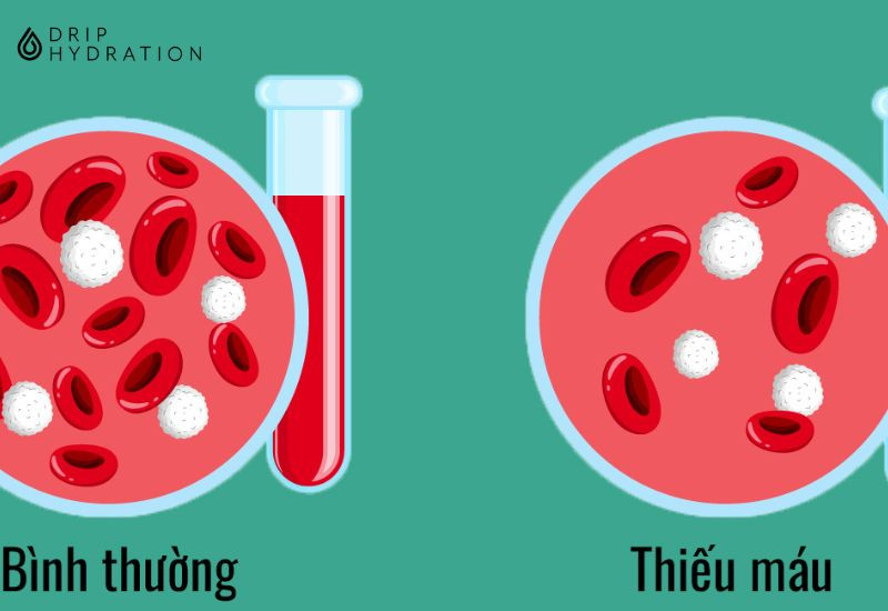 kết quả xét nghiệm máu MCHC là gì