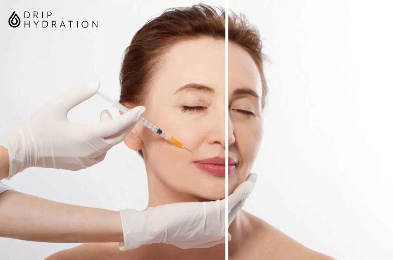 tiêm botox có tốt hơn filler không