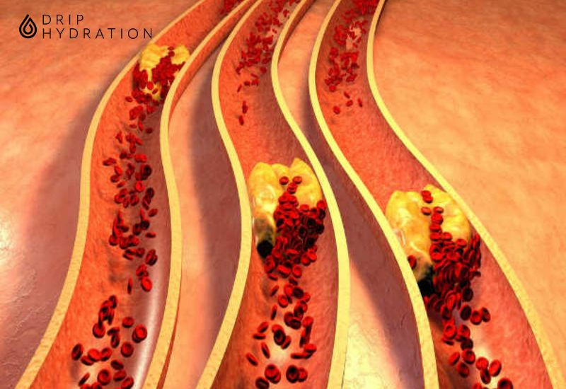 mất bao lâu để giảm cholesterol