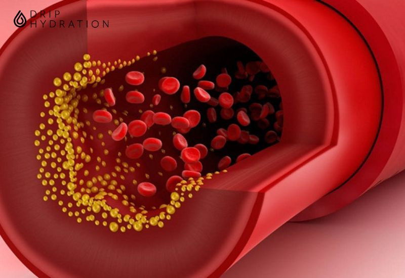 cholesterol xấu