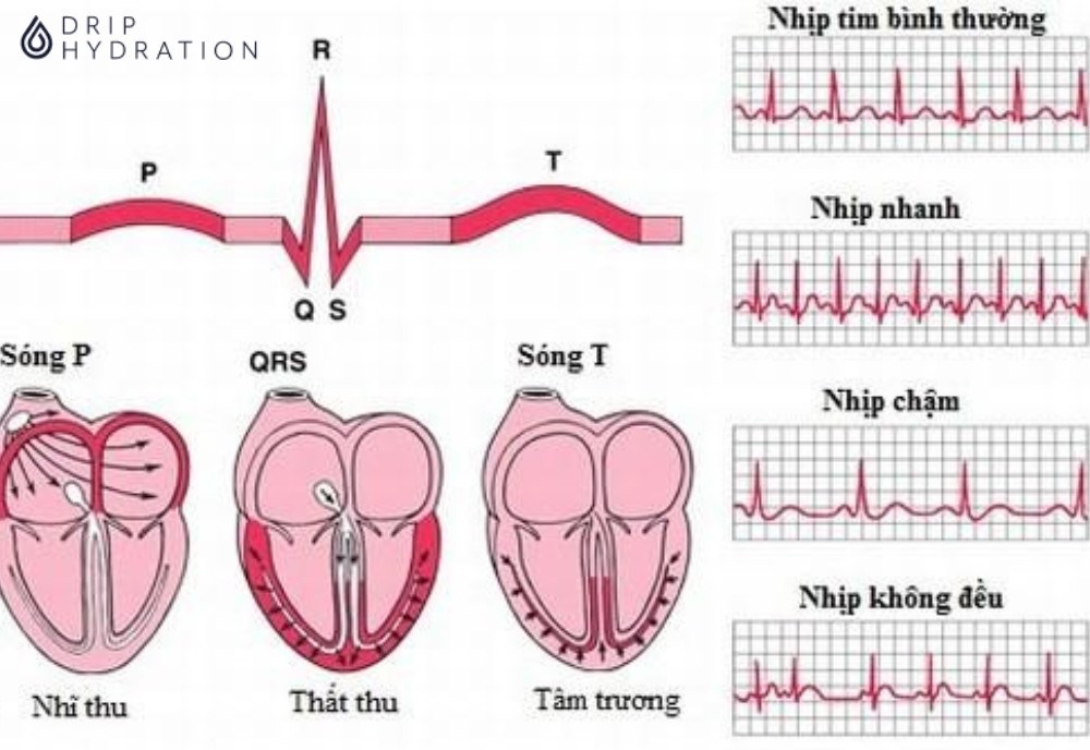 Rối loạn nhịp tim có thể xuất hiện ở mọi lứa tuổi