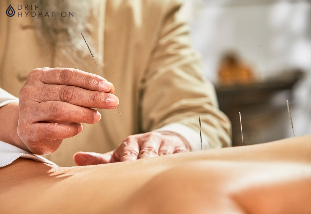 Châm cứu giúp làm giảm chứng ngưng thở khi ngủ hiệu quả