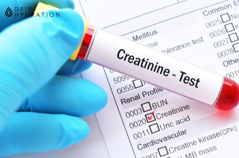 xét nghiệm máu Creatinine