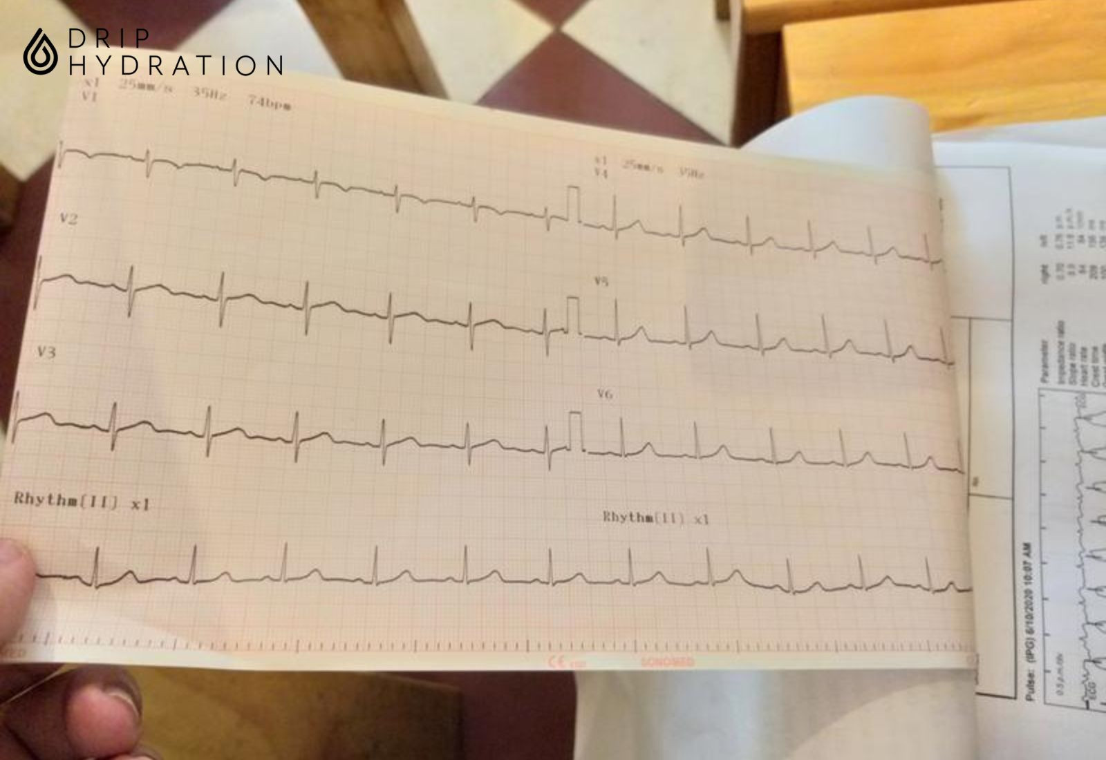 Chụp Điện Não Đồ (EEG) - Giải Pháp Hiệu Quả Trong Chẩn Đoán Bệnh Lý Về Não