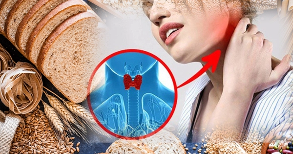 Cân nhắc giảm gluten nếu mắc bệnh tuyến giáp tự miễn 