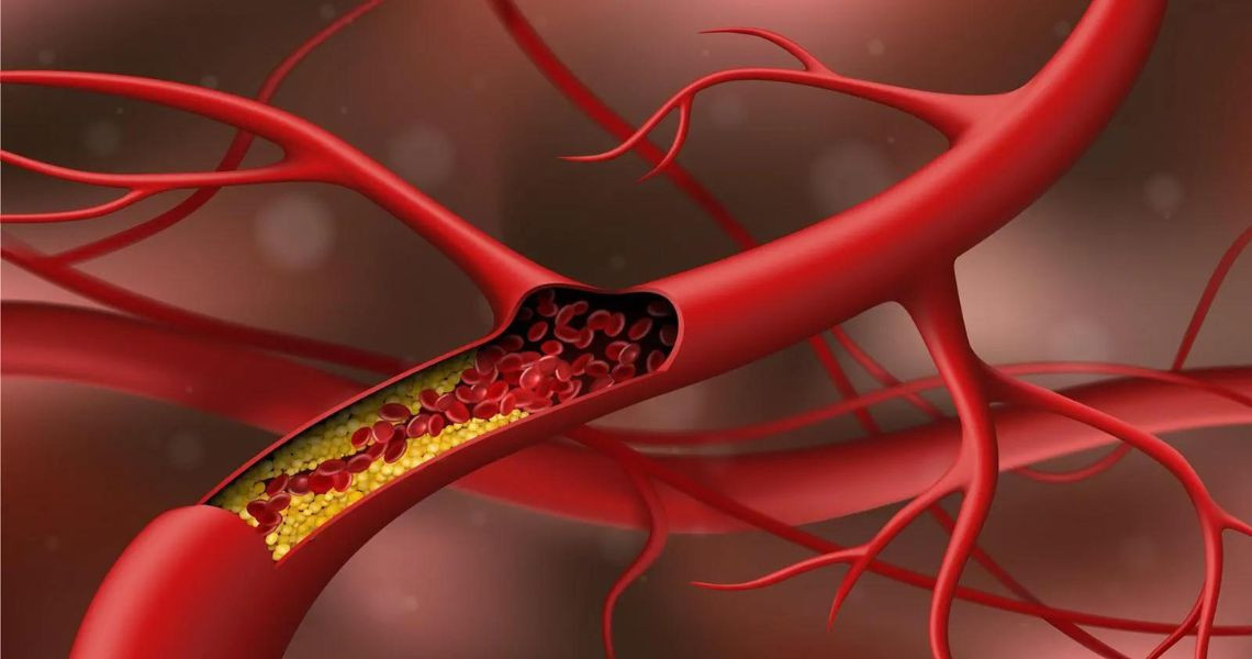 Cholesterol trong cơ thể bạn đến từ đâu?