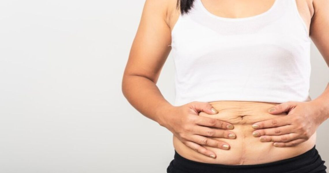 Mỡ thừa ở vùng bụng có ảnh hưởng đến bệnh gì?