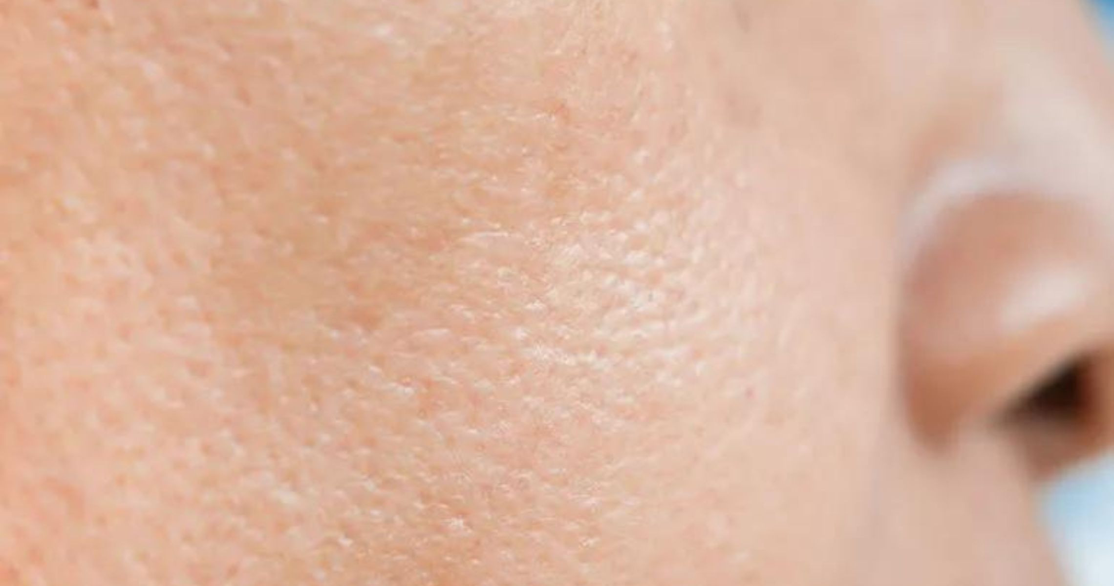 Cách nào thu nhỏ lỗ chân lông trên da mặt?
