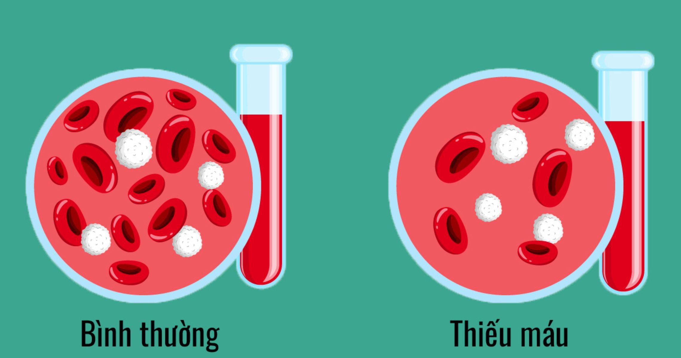 6 Vitamin cho bệnh thiếu máu