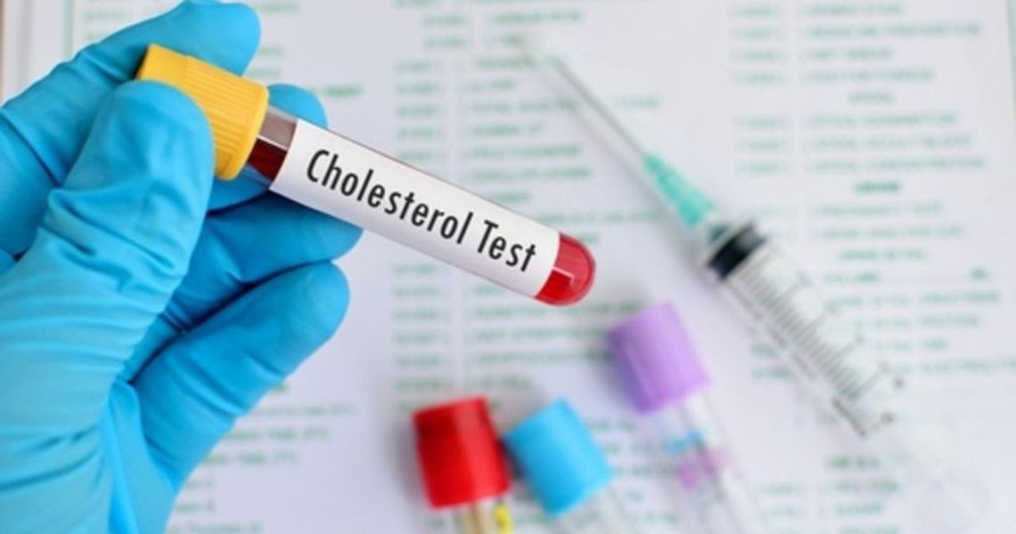 Chỉ số Cholesterol trong xét nghiệm máu là gì?