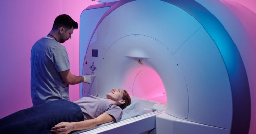 Chỉ định chụp MRI mạch máu não