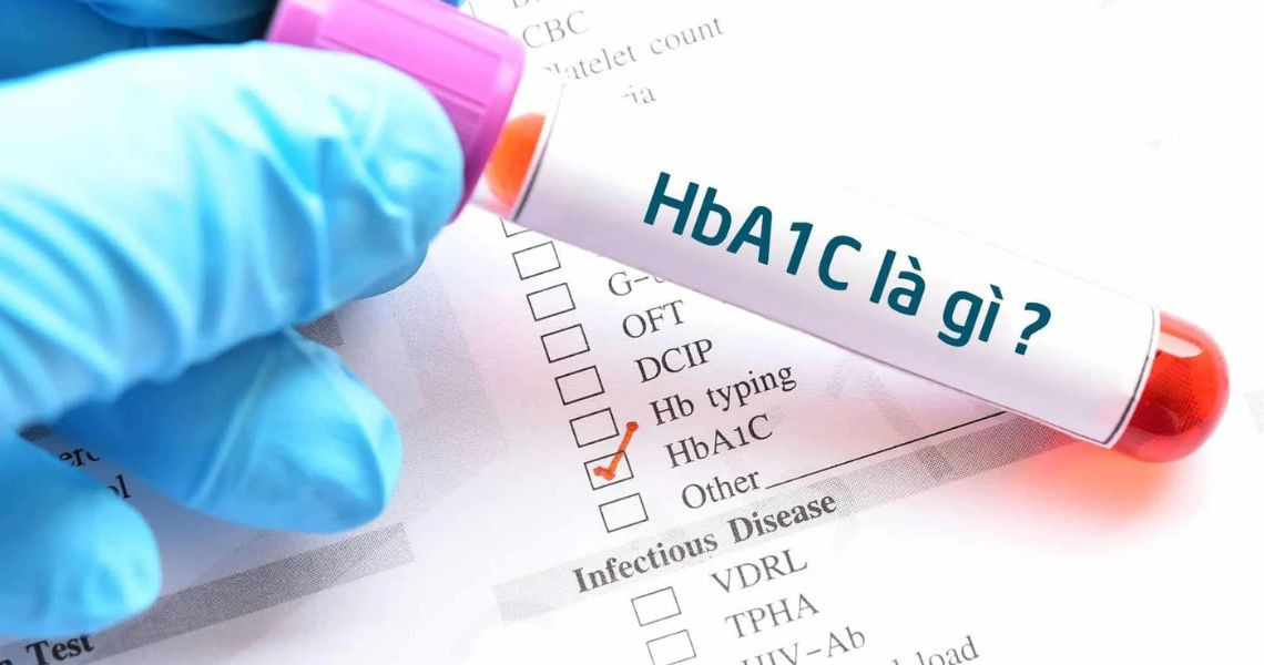 Mục đích của xét nghiệm HbA1c trong máu