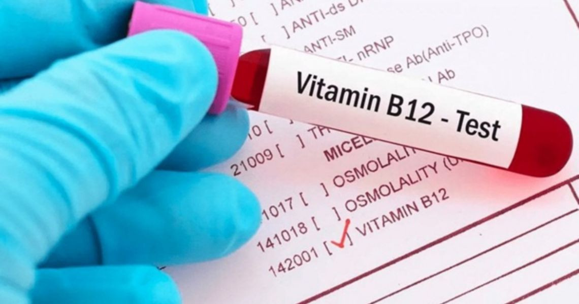 Ai cần xét nghiệm vitamin B12?