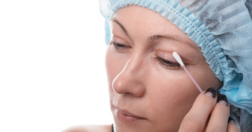 Cảnh giác sụp mí sau khi tiêm Botox