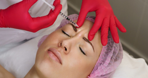 Bị đau đầu sau khi tiêm botox có phải là phản ứng phụ thường gặp?