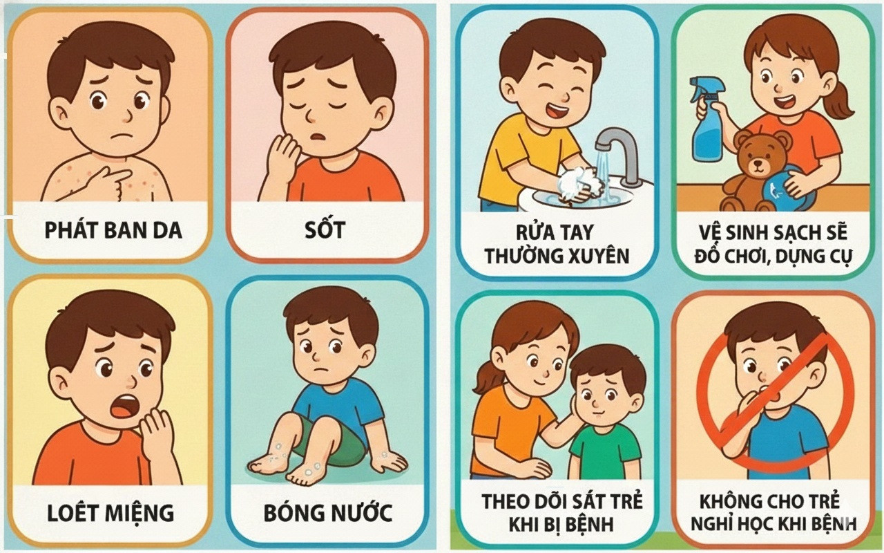 Sở Y tế TP.HCM cảnh báo tác nhân EV71 xuất hiện trở lại