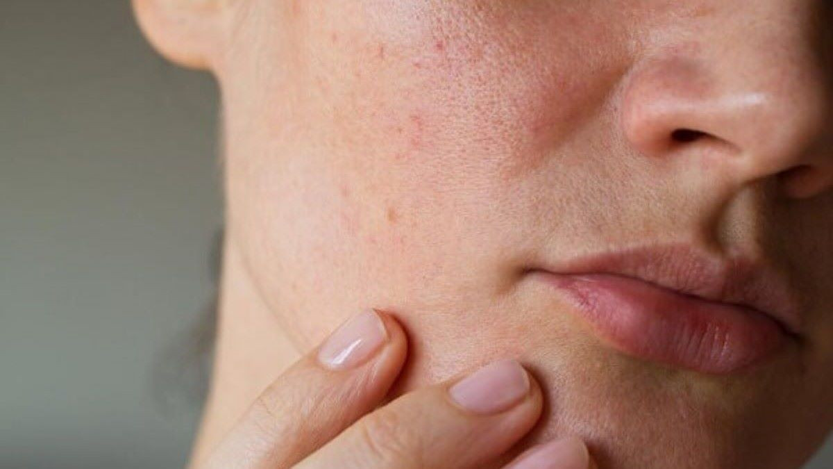 Da xỉn màu là gì? Làm thế nào để khắc phục?