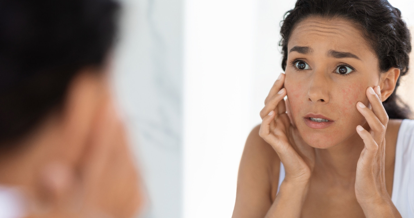 Vì sao da bị tăng sắc tố da sau viêm và cách nào điều trị?
