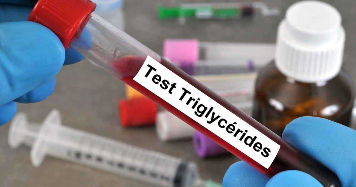 Mức triglyceride trong xét nghiệm máu thế nào là bình thường?