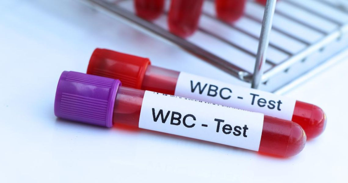 Chỉ số WBC trong xét nghiệm máu là gì?