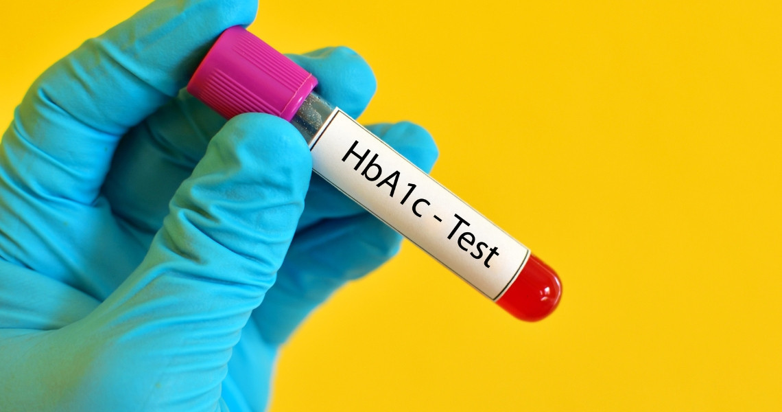 HbA1C trong xét nghiệm máu là gì?