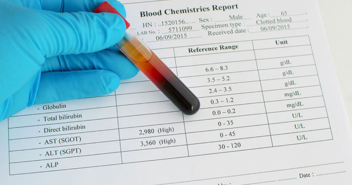 Chỉ số AST trong xét nghiệm máu như thế nào là cao, thấp, bình thường?